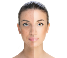 How to Get Rid of Dull Skin Fast